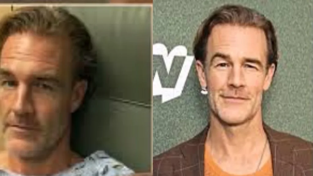James Van Der Beek